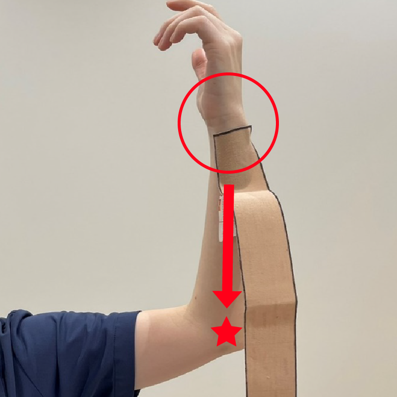 手首の小指側、しわの下あたりにテープの端を貼ります。そこから肘の内側の痛みがある部分（★）に向かって貼ります。