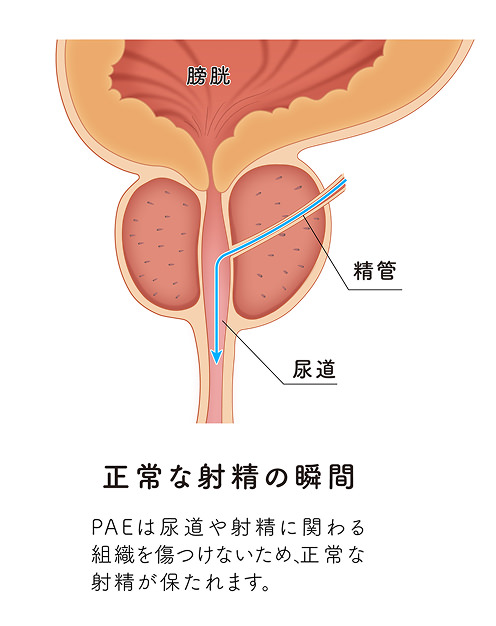正常な射精の瞬間のイメージ画像