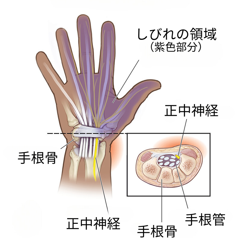 手根骨