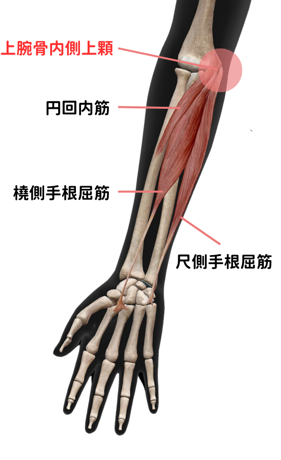 ゴルフ肘に関連する円回内筋と屈筋群