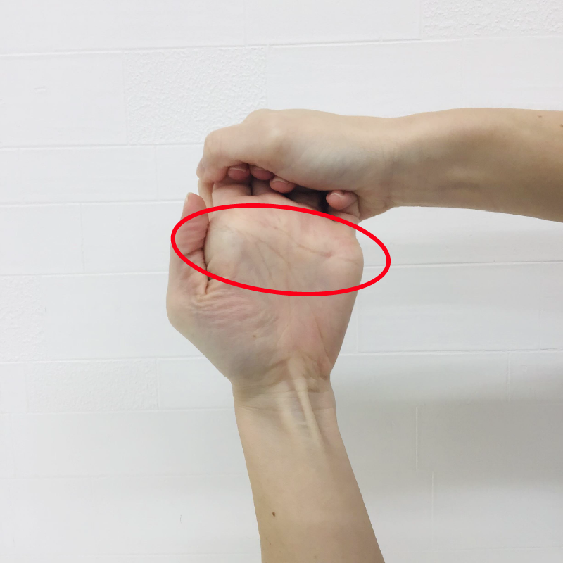 手のひら側から見た写真 赤い丸の部分に伸張感があります。