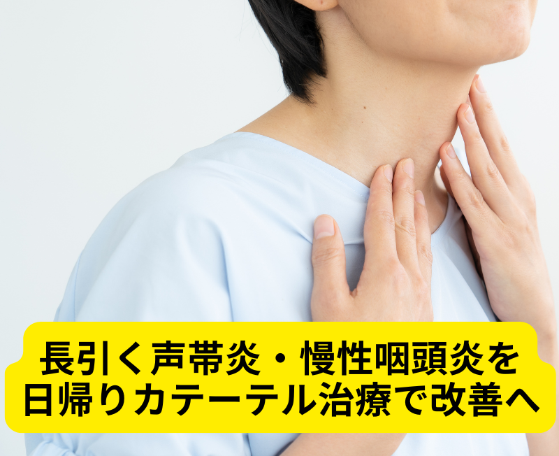 喉に手を当てて声のかすれを気にする方。長引く声帯炎・慢性咽頭炎を日帰りカテーテル治療で改善へ