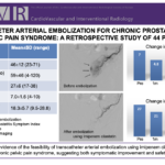 慢性前立腺炎・骨盤痛に対して、カテーテルを使った動脈塞栓術を行ったらどうなったか？