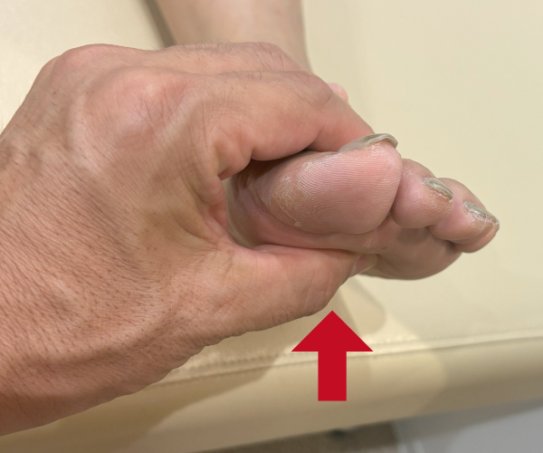 thumb index finger squeeze test