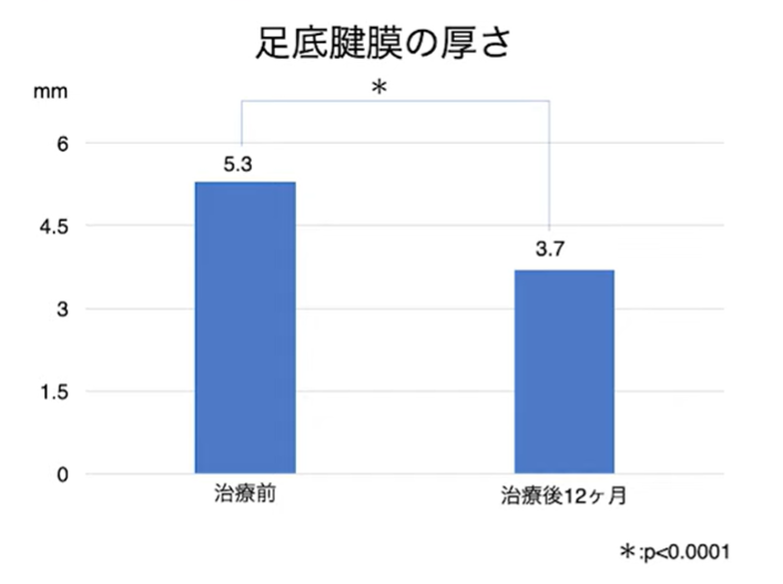 足底腱膜の厚さ