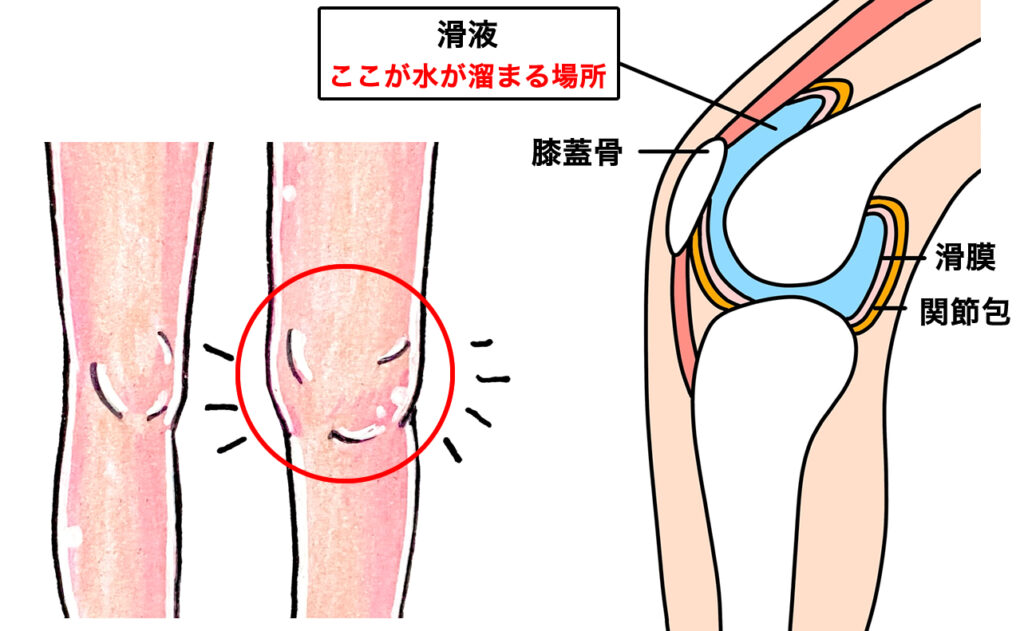 滑液　ここが水が溜まる場所