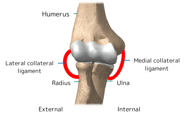 tennis elbow